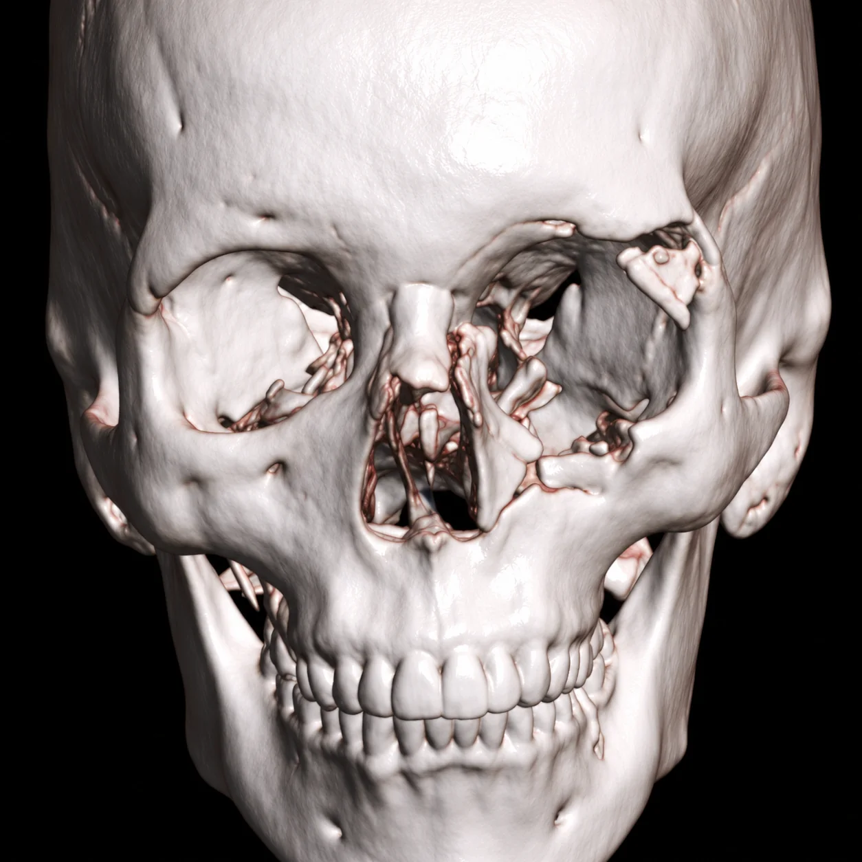 Cirurgia bucomaxilofacial e reconstrução